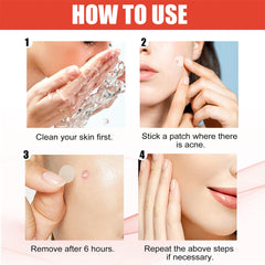 Hydrocolloid Acne Patch Invisible Closed Acne Patch Invisible Acne Face Invisible Waterproof Breathable Acne Skin Patch
